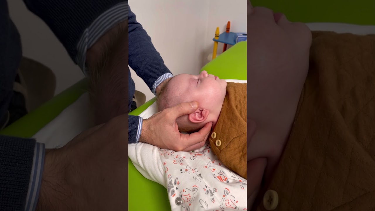 OSTEOPATIA NEONATALE, Trattamento manipolativo cervicale per torcicollo miogeno del neonato
