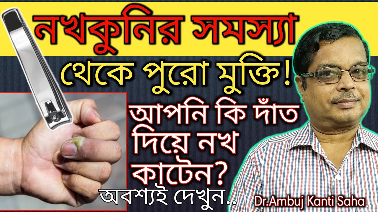 নখকুনির permanent solution কয়েক দিন এ | Paronychia sign, symptoms & treatment in Bengali | homeopath