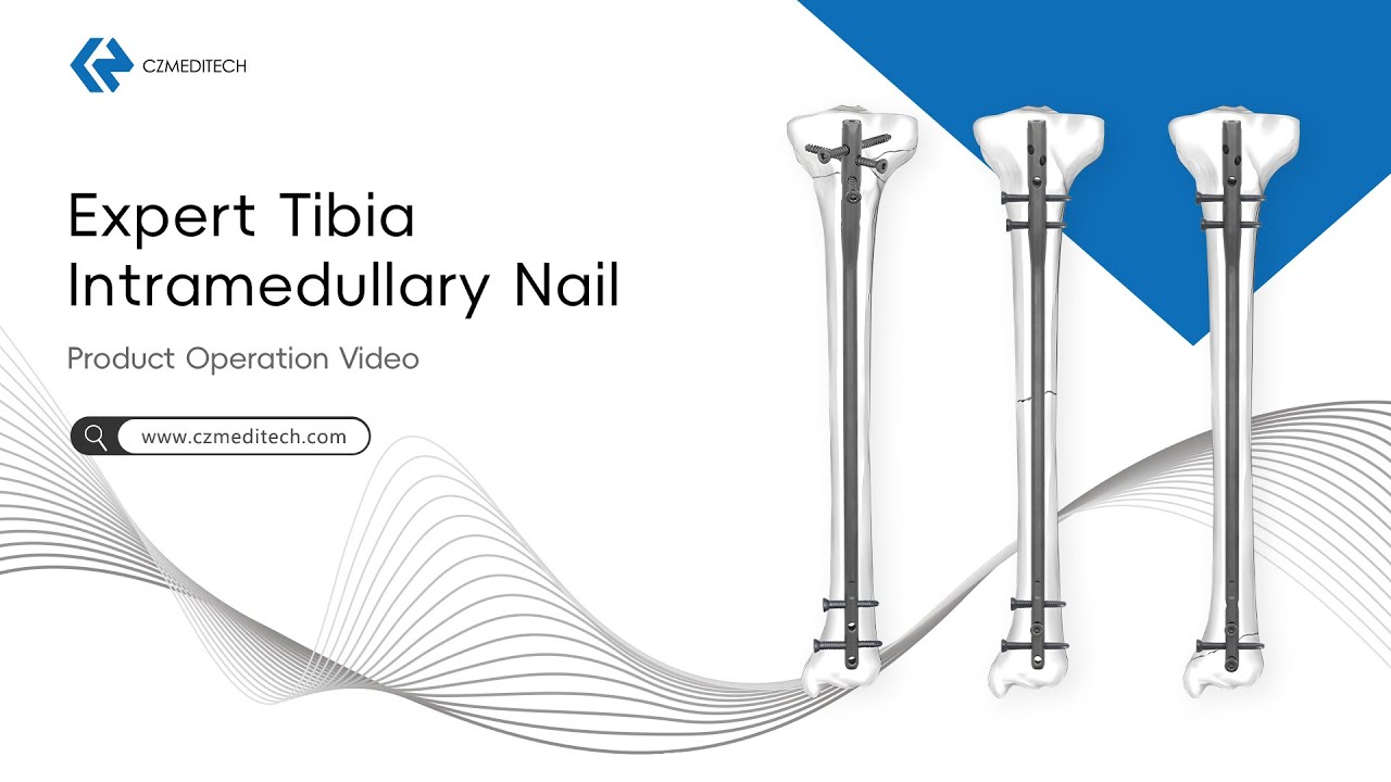 Expert Tibia Intramedullary Nail Surgical Technique | Tibial IM Nail Operation Guide