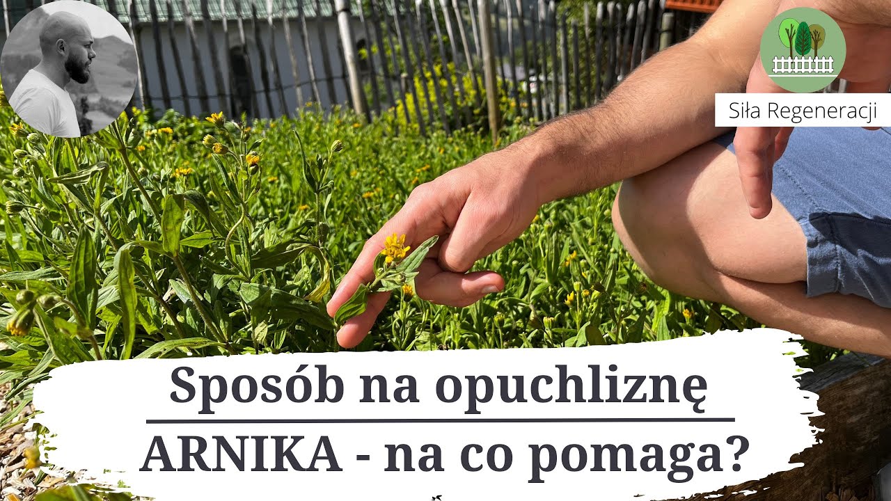 Spos&oacute;b na opuchliznę - Arnika na co pomaga
