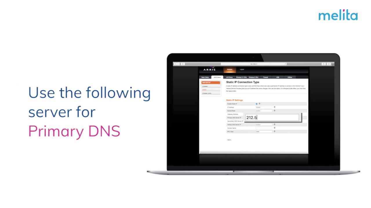 How to configure your static IP on Arris modem