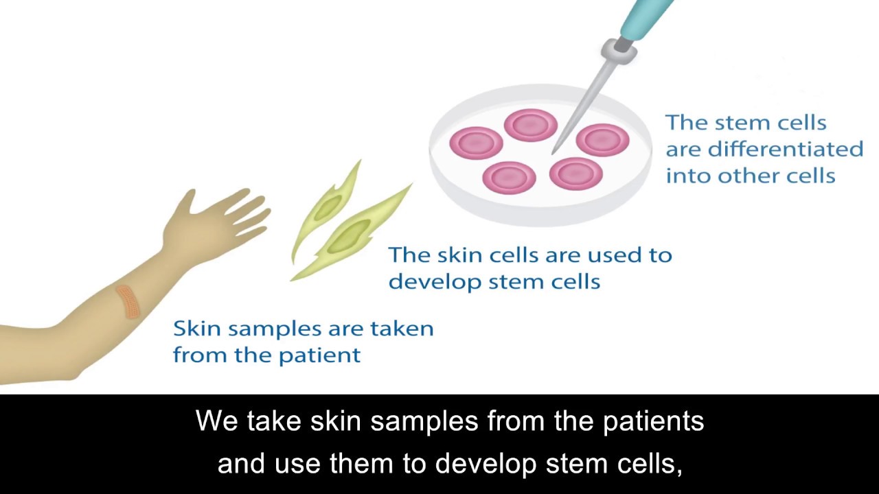 How IPS stem cells help combat heart diseases