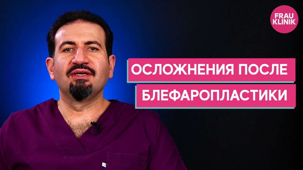 ОСЛОЖНЕНИЯ ПОСЛЕ БЛЕФАРПЛАСТИКИ - СОЛОМОН МАИСОВИЧ АБРАМЯН