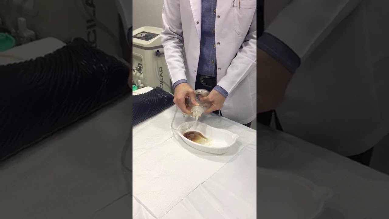 Dren nasıl boşaltılır?