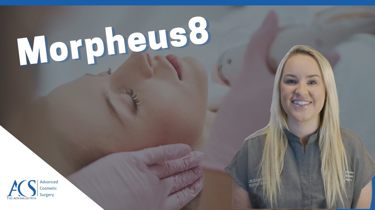 The Morpheus8 Treatment: What is it, Risks, Results, How to Prepare, What to Expect, Cost and More!