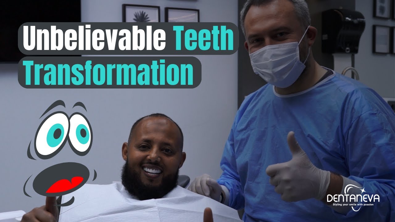 Unbelievable teeth restoration: Patient from the UK