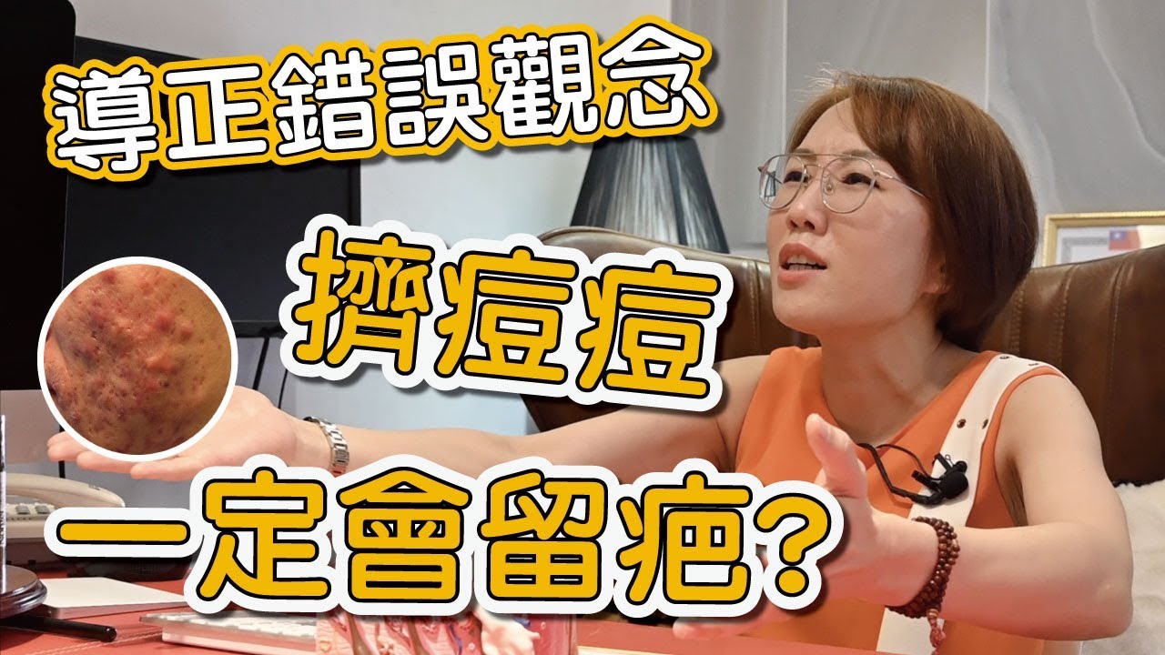 擠痘痘會不會留疤？你常聽到青春痘治療的觀念正確嗎?