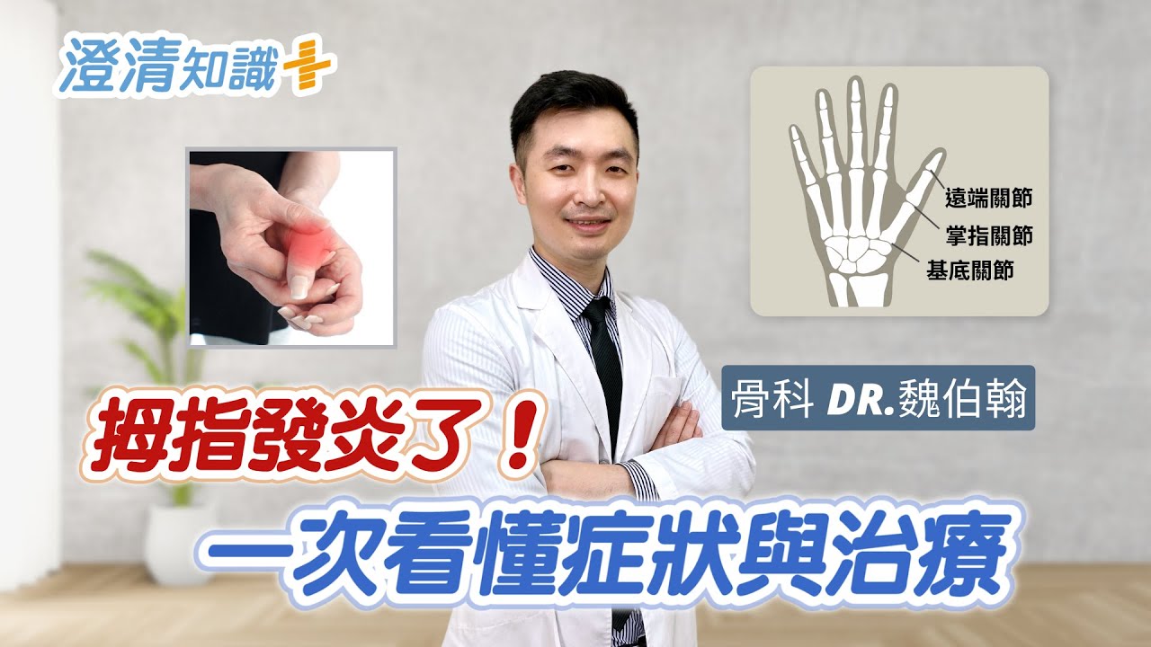 【澄清知識＋】拇指發炎了！一次看懂症狀與治療 -骨科 魏伯翰醫師