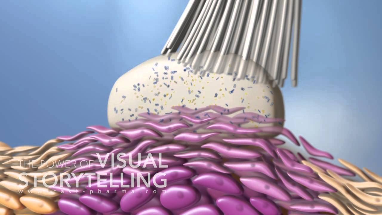 Actinic Keratosis Mode of Action Animation