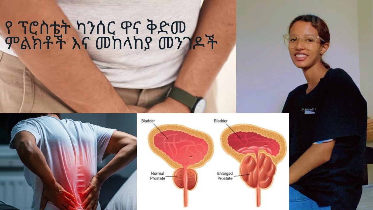 ፕሮስቴት ካንሰር ( treatment of prostate cancer )