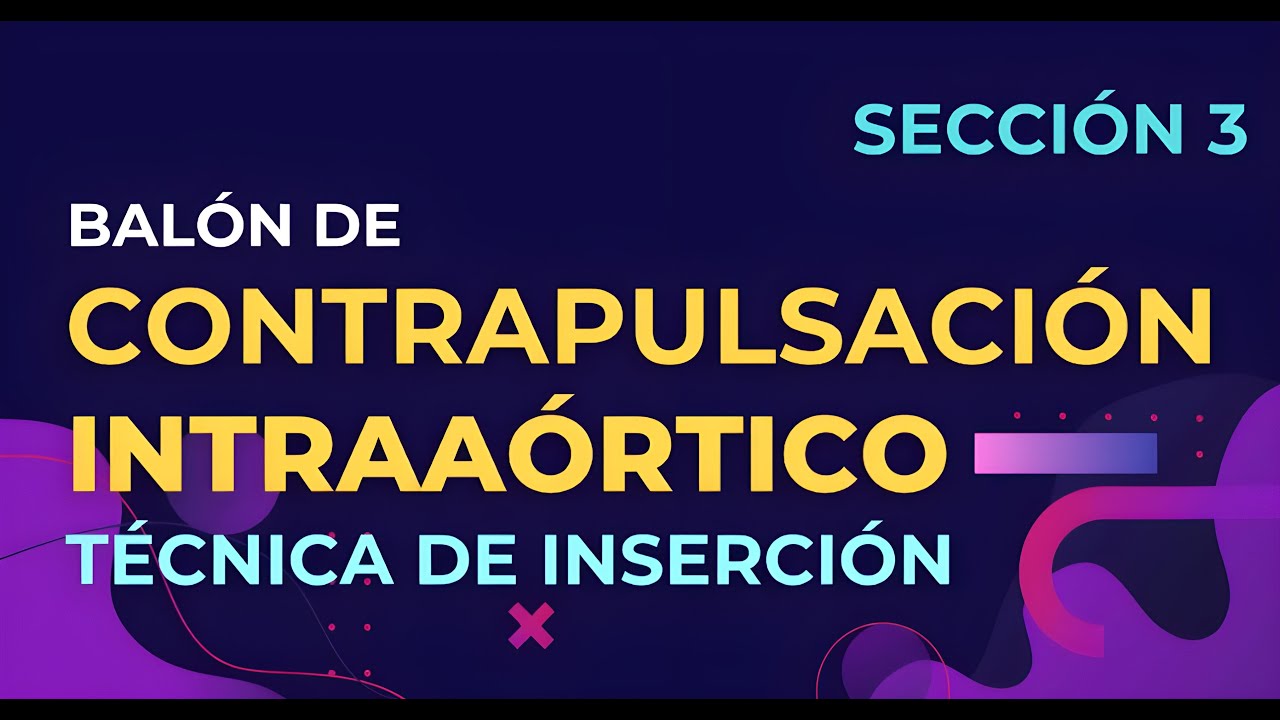 Técnica de Inserción del Balón de Contrapulsación Intraaórtico | Sección 3 #iabp #uci #perfusion