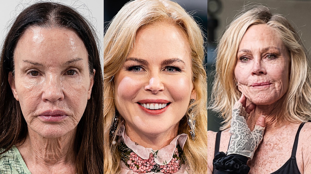 15 Hollywood Stars Whose Facelifts Went Too Far (It's Getting Worse)