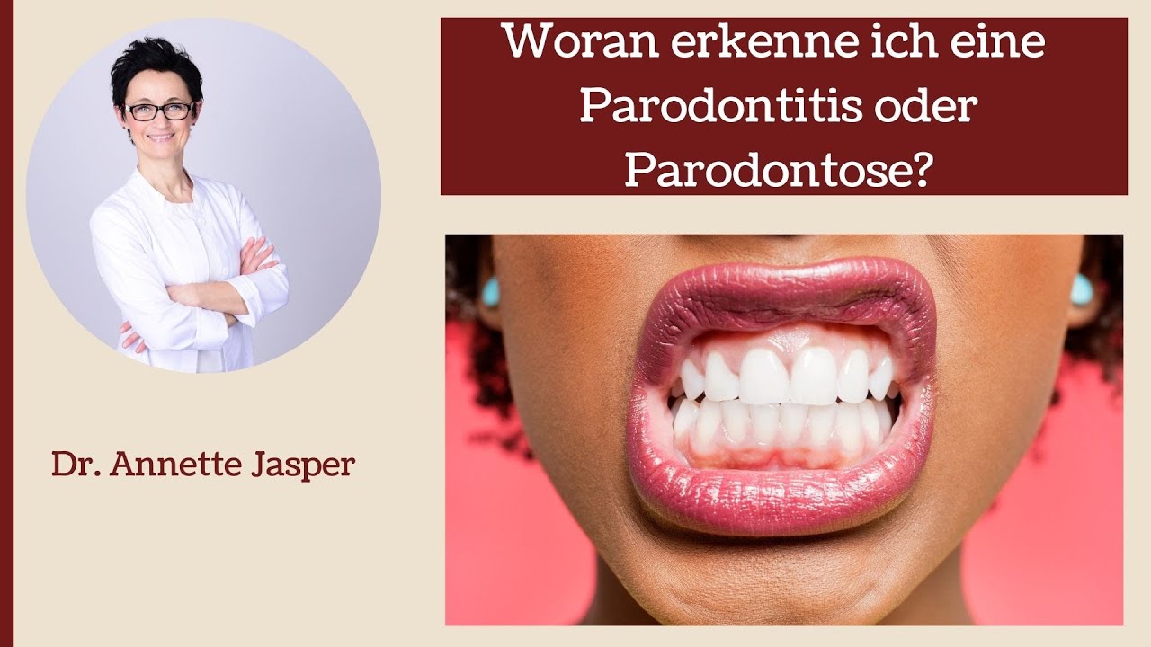 Woran erkenne ich eine Parodontitis oder Parodontose?