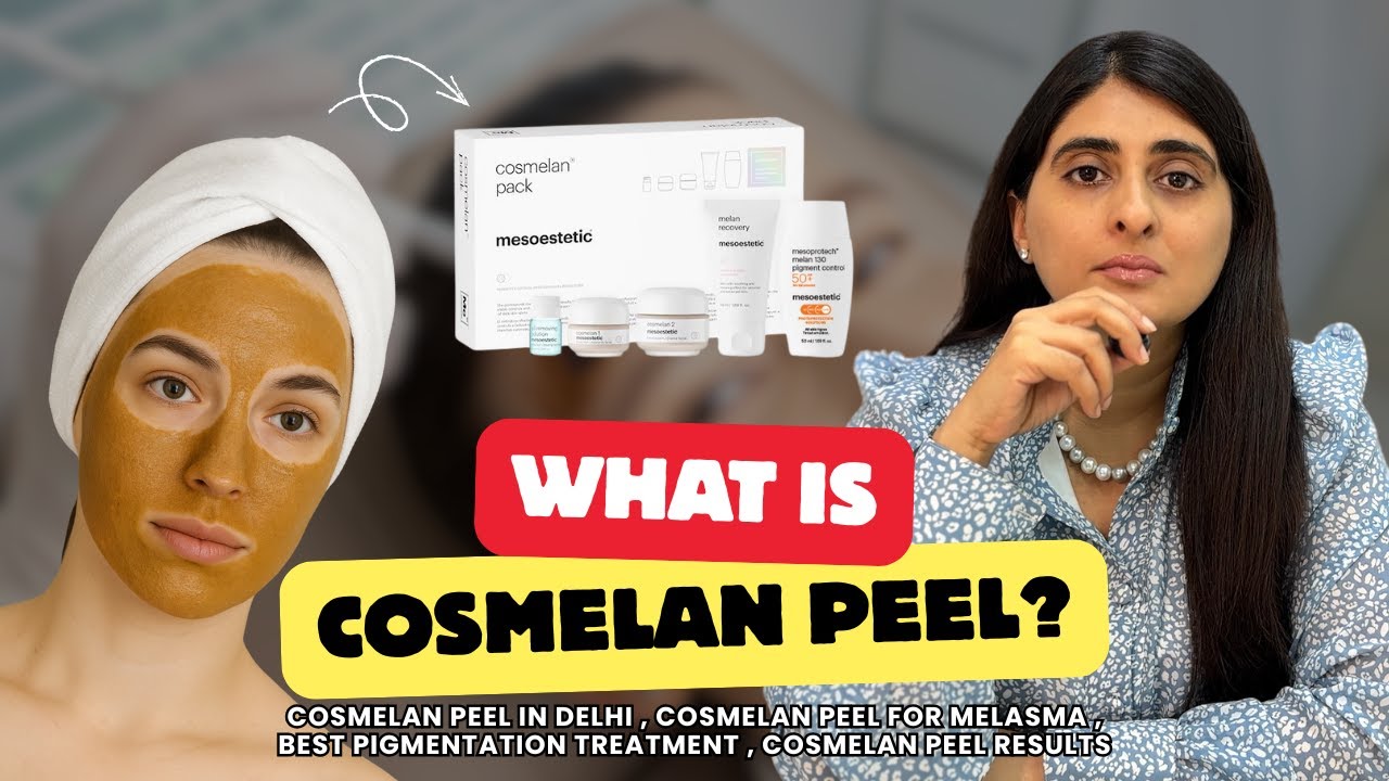 Cosmelan Peel | Cosmelan Peel cost in India | Everything You Should Know About Cosmelan Peel