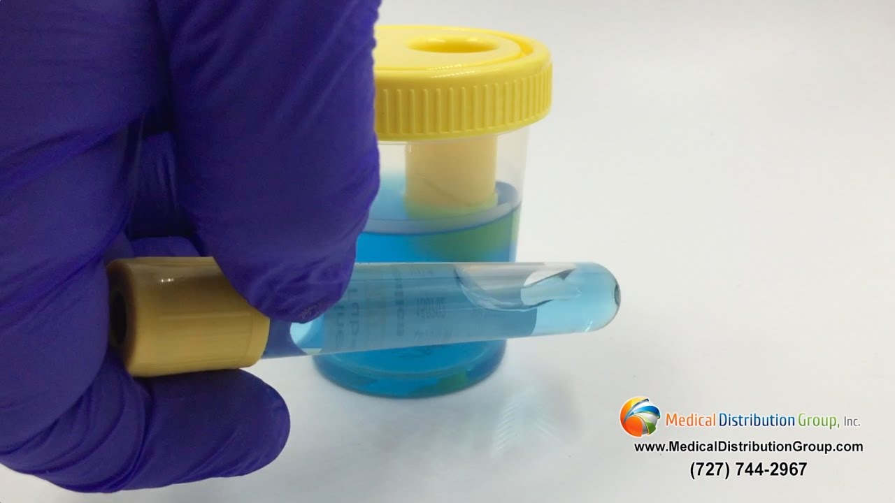 Vacuum Urine Collection Cups - Vacuum Urinalysis Tubes 10mL or 5mL