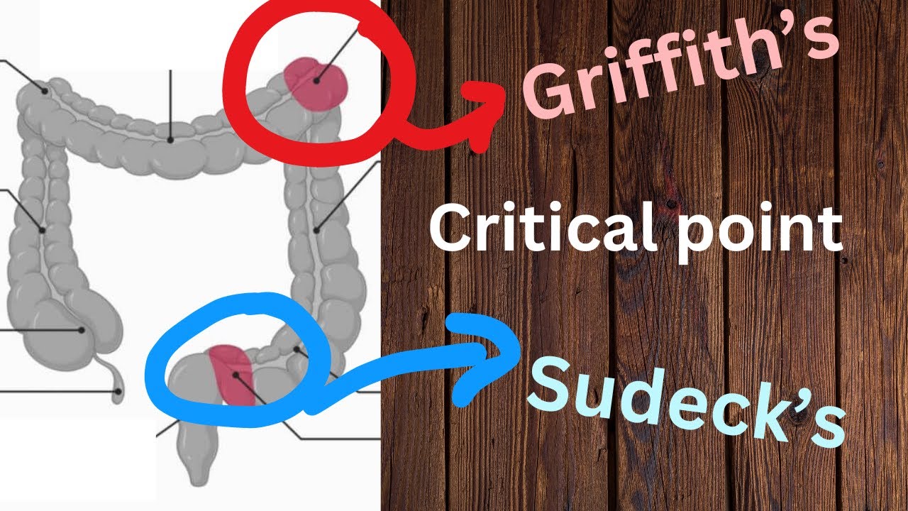 Griffith's and Sudeck's point - IN ONE MINUTE