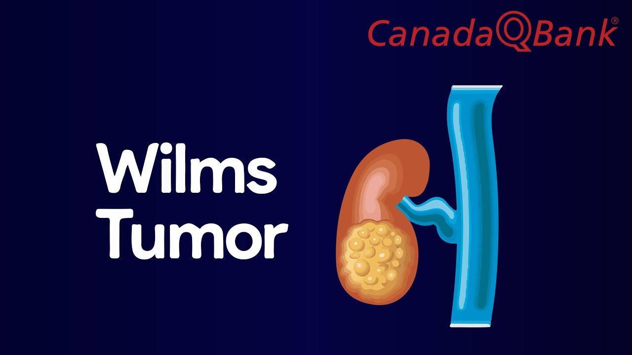 Wilms Tumor Explained | Pediatric Kidney Cancer, Diagnosis & Treatment | CanadaQBank