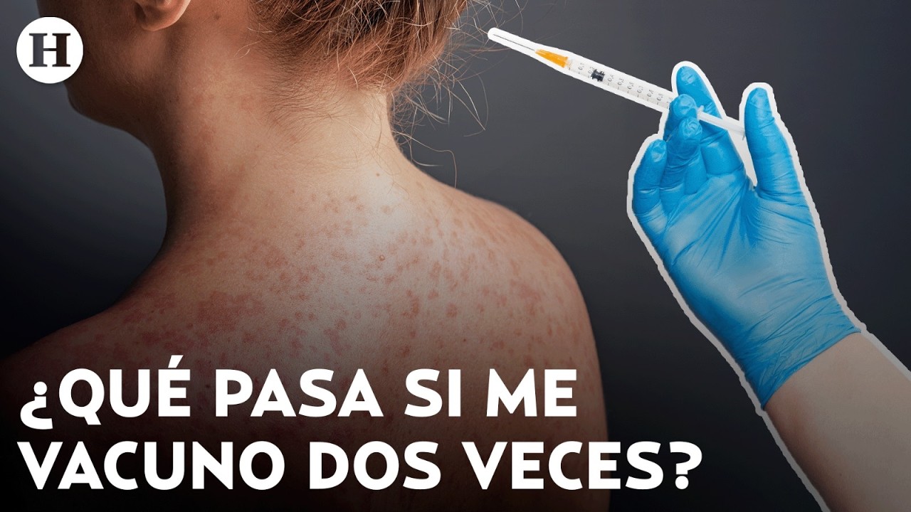 ¿Es peligroso vacunarte otra vez? Estos son los refuerzos contra sarampión que debes tener