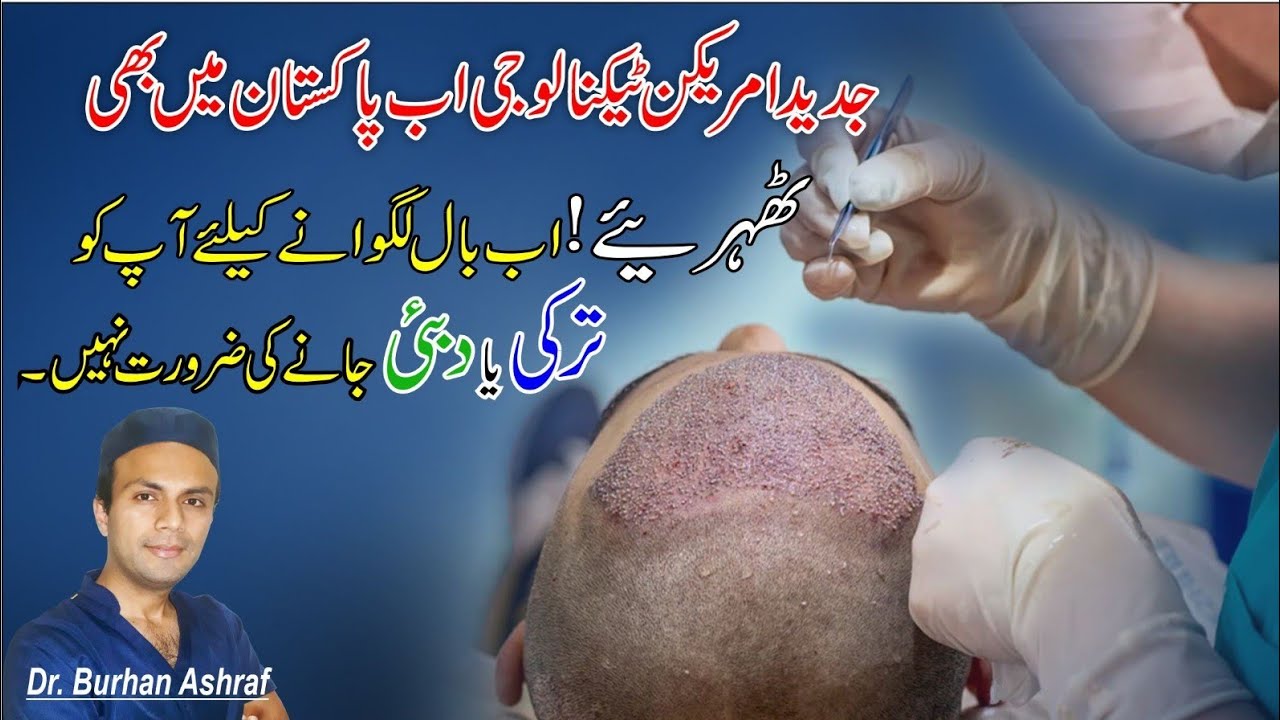 FUE Hair Transplant Pakistan | Dr Burhan Ashraf