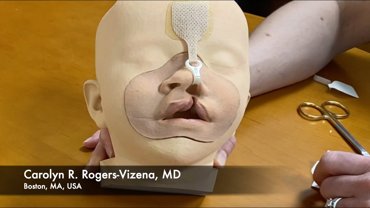 How to use the DynaCleft® Nasal Elevator