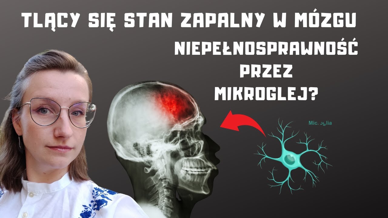 Tlące się stwardnienie rozsiane - POGORSZENIE bez rzutów. Stan zapalny w mózgu i rdzeniu |O,choroba!
