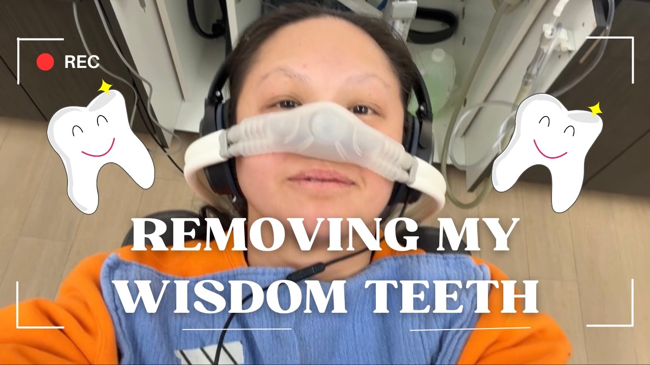 My Wisdom Teeth Removal & Recovery