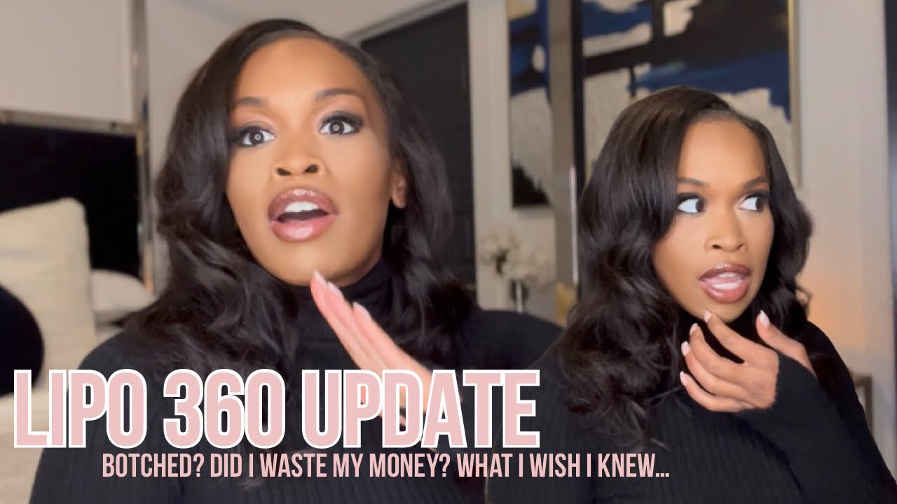 Lipo 360 Update + Body Reveal | Do I Regret Surgery? What I Wish I Knew - MIA AESTHETICS