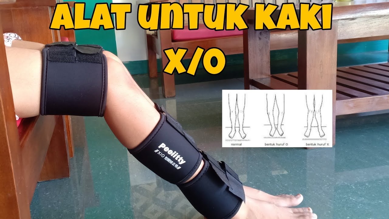 ALAT ORTHOSIS UNTUK KAKI X/O