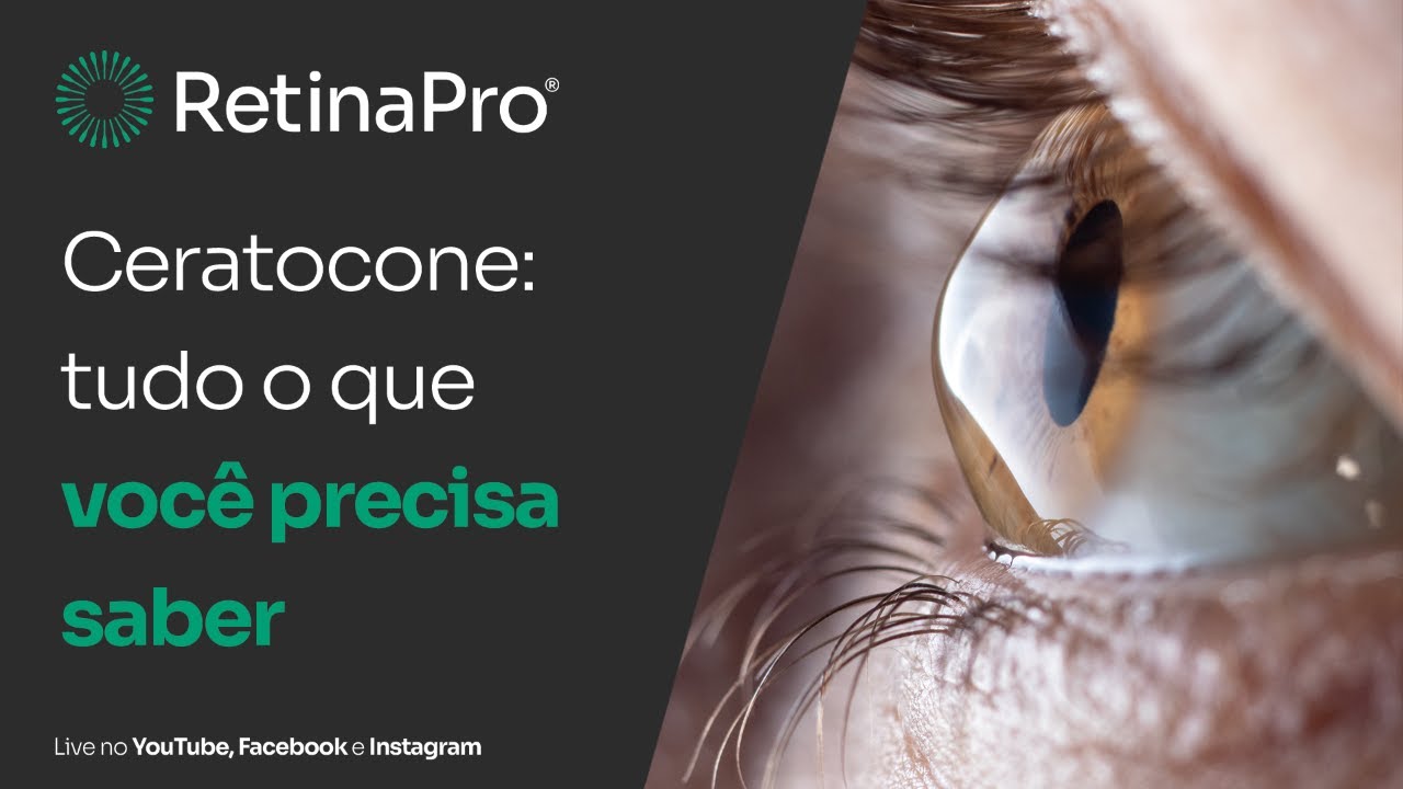 Ceratocone: tudo o que você precisa saber a respeito