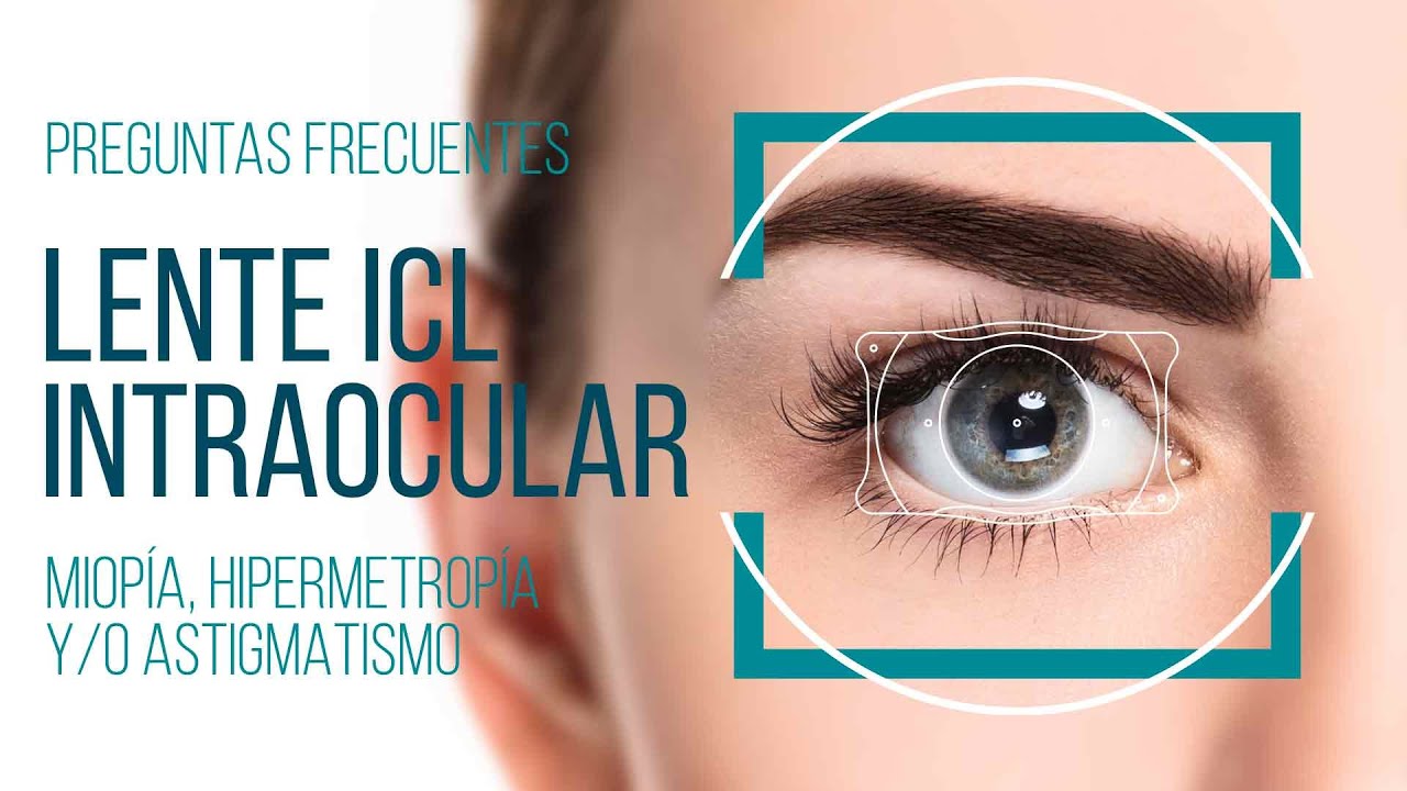 PREGUNTAS FRECUENTES ICL LENTES INTRAOCULARES