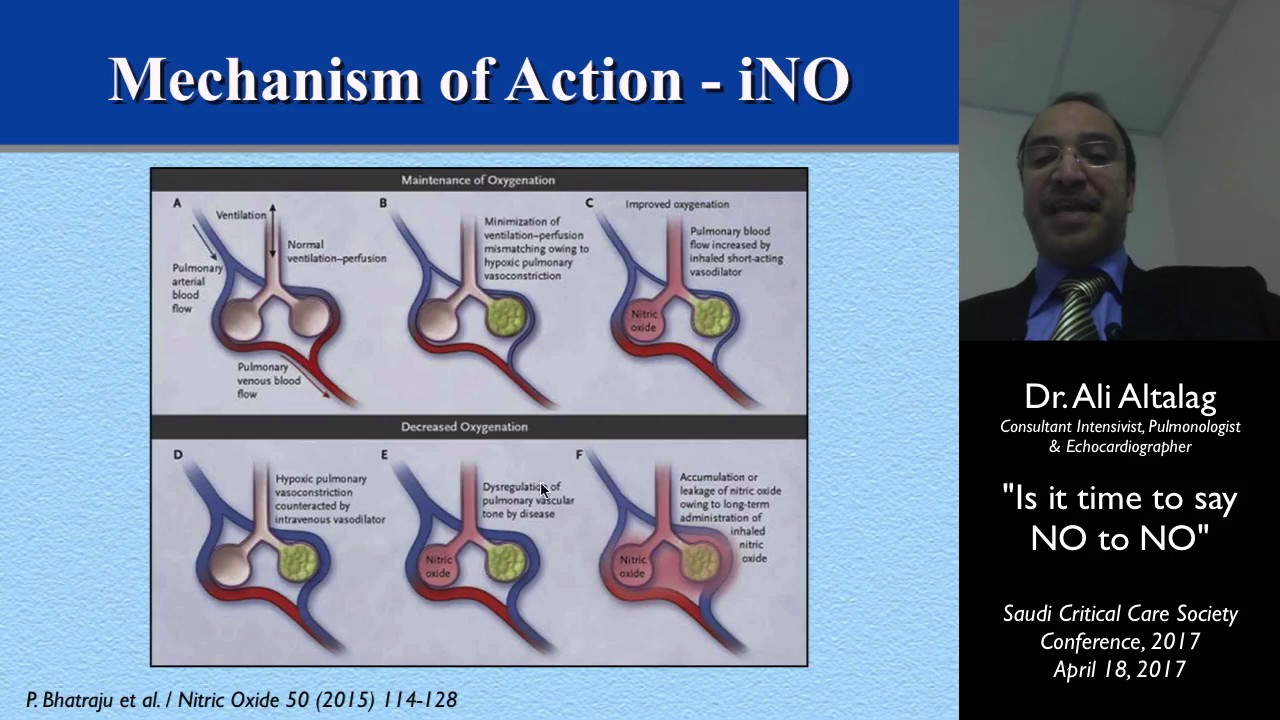 Inhaled Nitric Oxide in ARDS