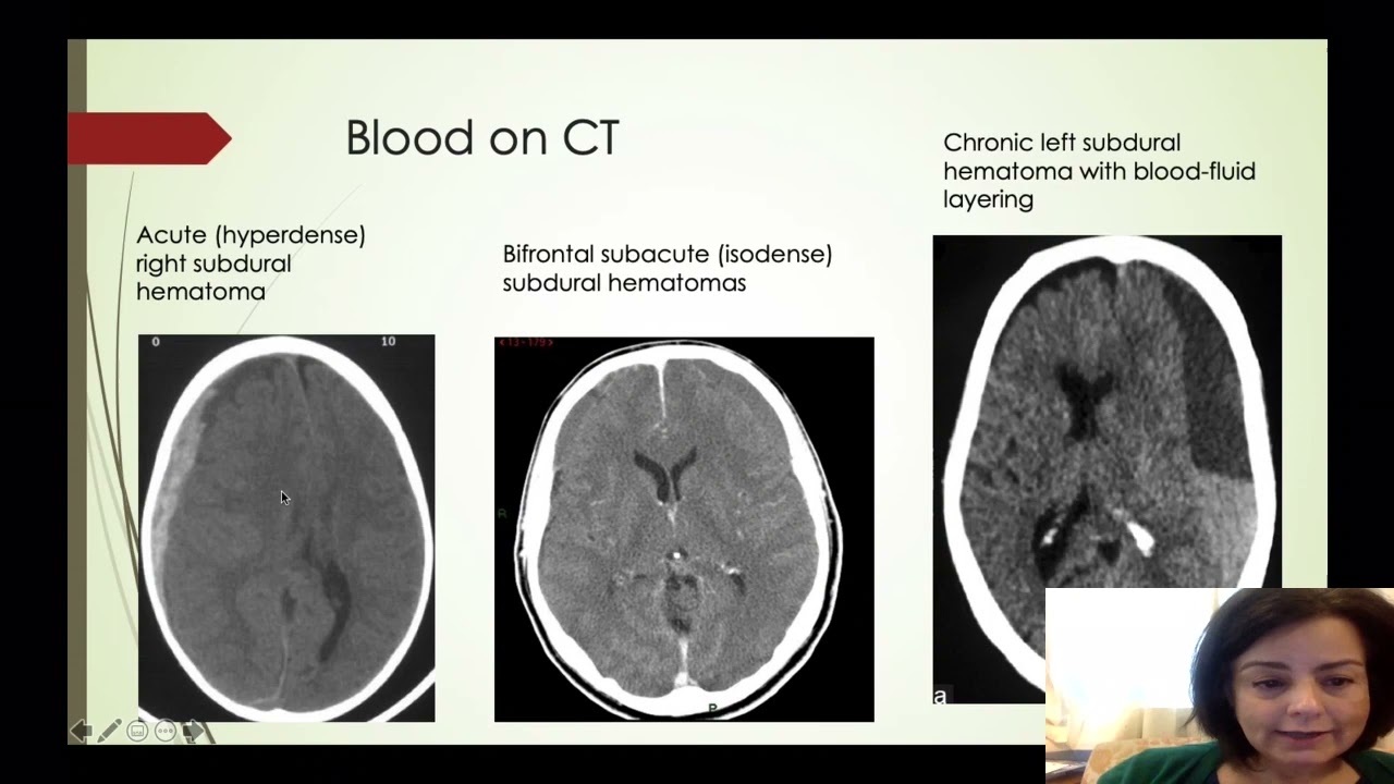 Basic Neuroimaging