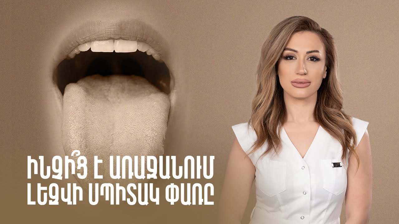 Ինչի՞ց է առաջանում լեզվի սպիտակ փառը |  Gastro Time 82