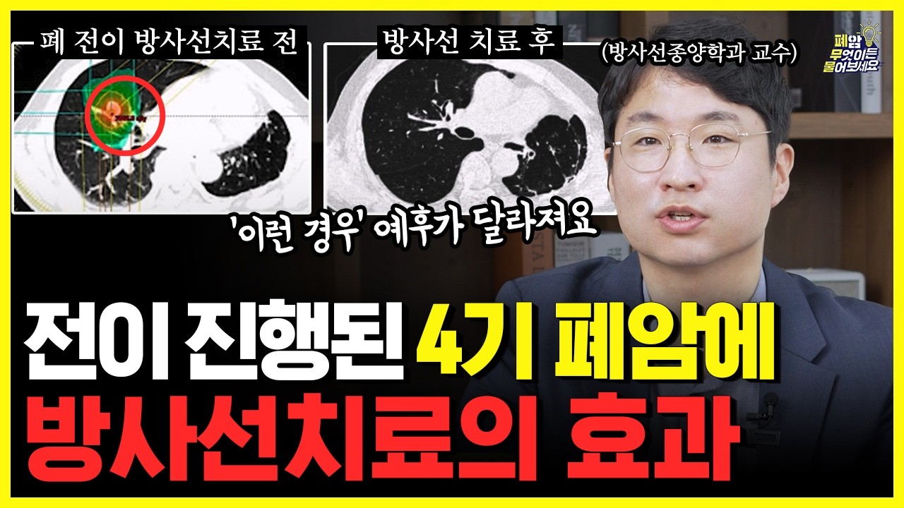 항암만으론 부족합니다…치료통증 줄이고 생존 늘리는 4기 폐암을 바꾼 ‘단 한 가지 치료’