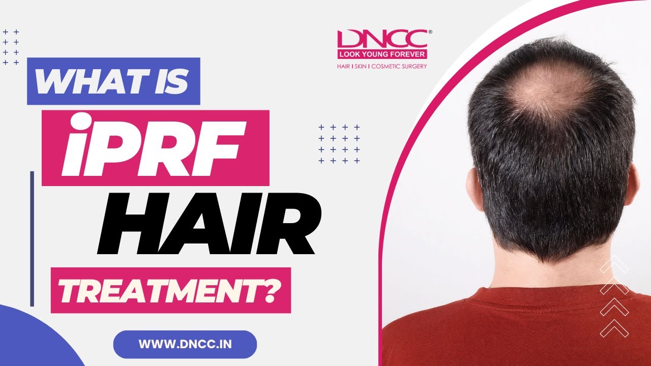 iPRF Treatment for Hair Growth, Injectable Platelet Rich Fibrin (iPRF) Treatment in India | DNCC