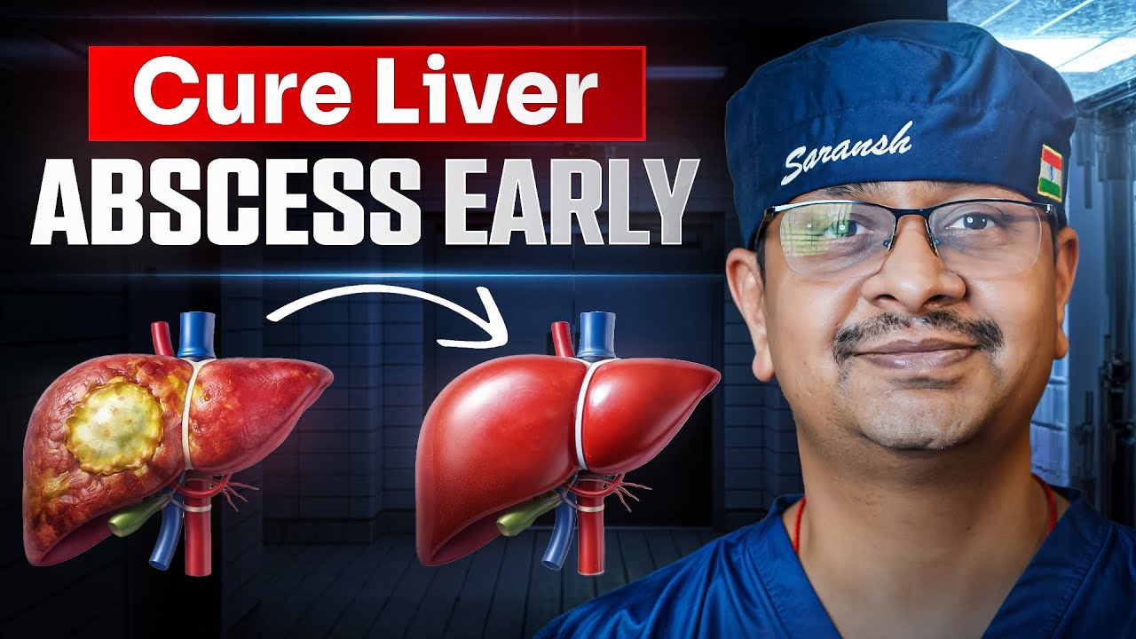 Liver Abscess क्या है? | लक्षण, कारण और इलाज | Liver में मवाद | Dr Saransh Jain