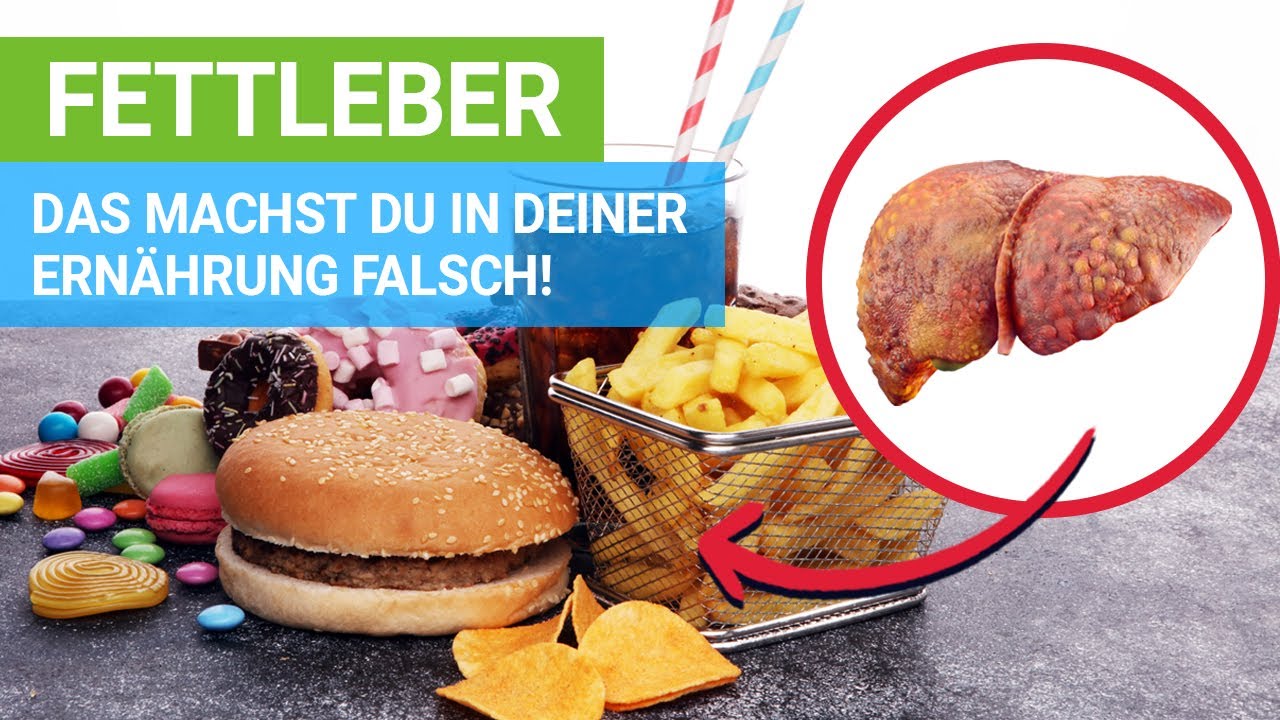 Fettleber: Das machst du in deiner Ernährung falsch