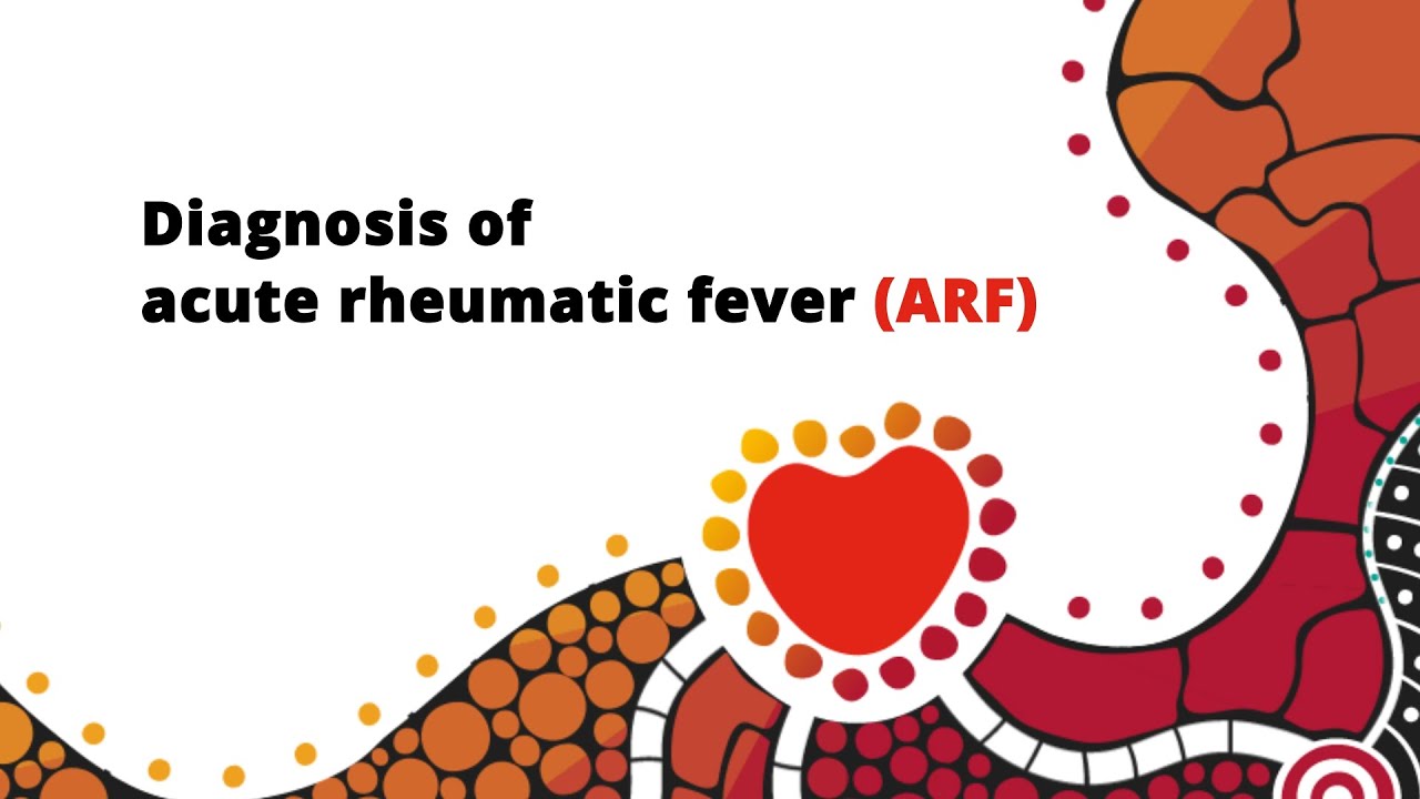 Diagnosis of acute rheumatic fever