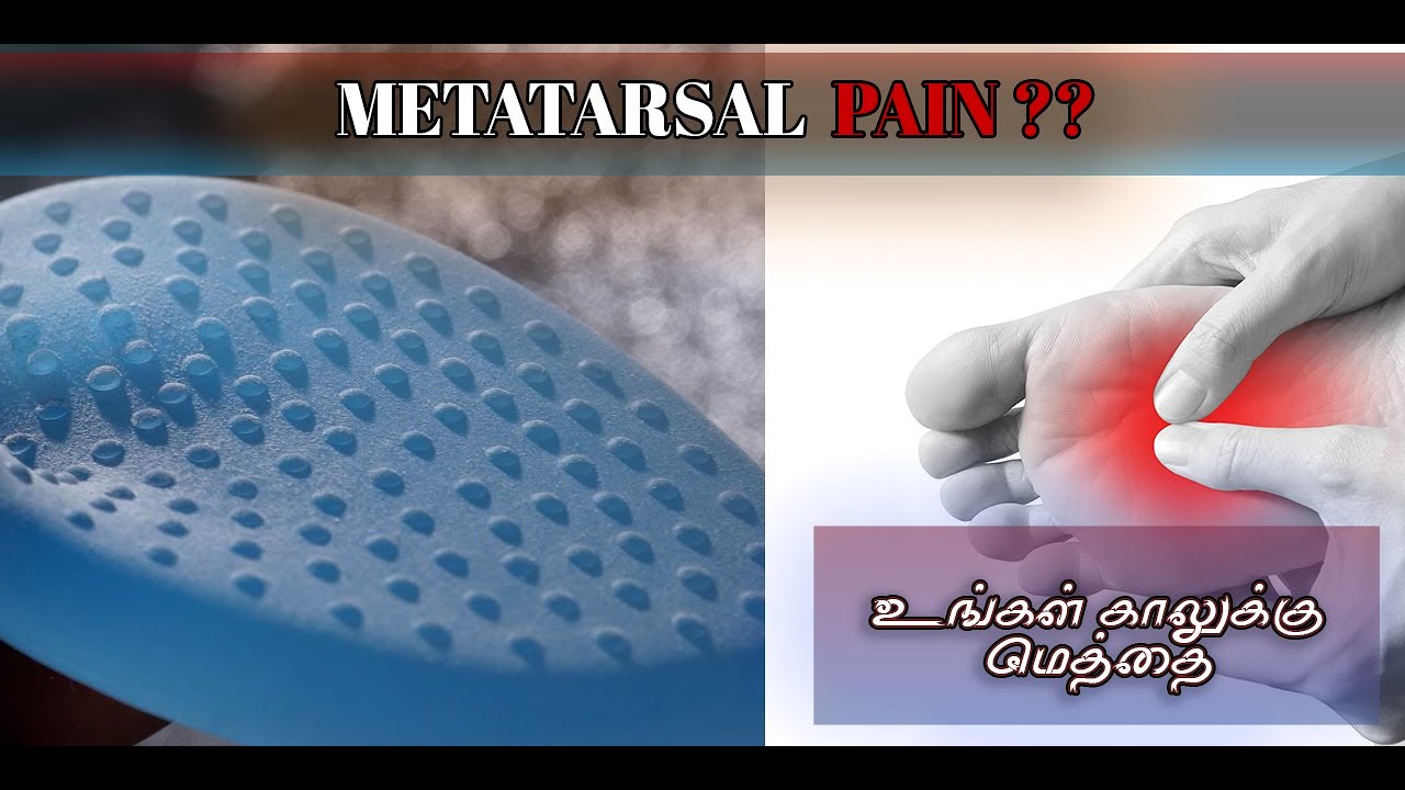 Metatarsal gel pads | Relief from Metatrasal Pain |
