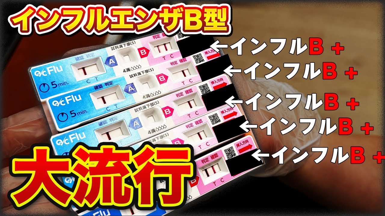 【緊急】インフルエンザB型が大流行【17年ぶり・・・？】