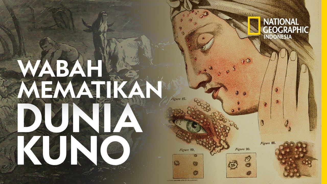 VIRUS CORONA VS Empat Wabah Mematikan Dunia Kuno