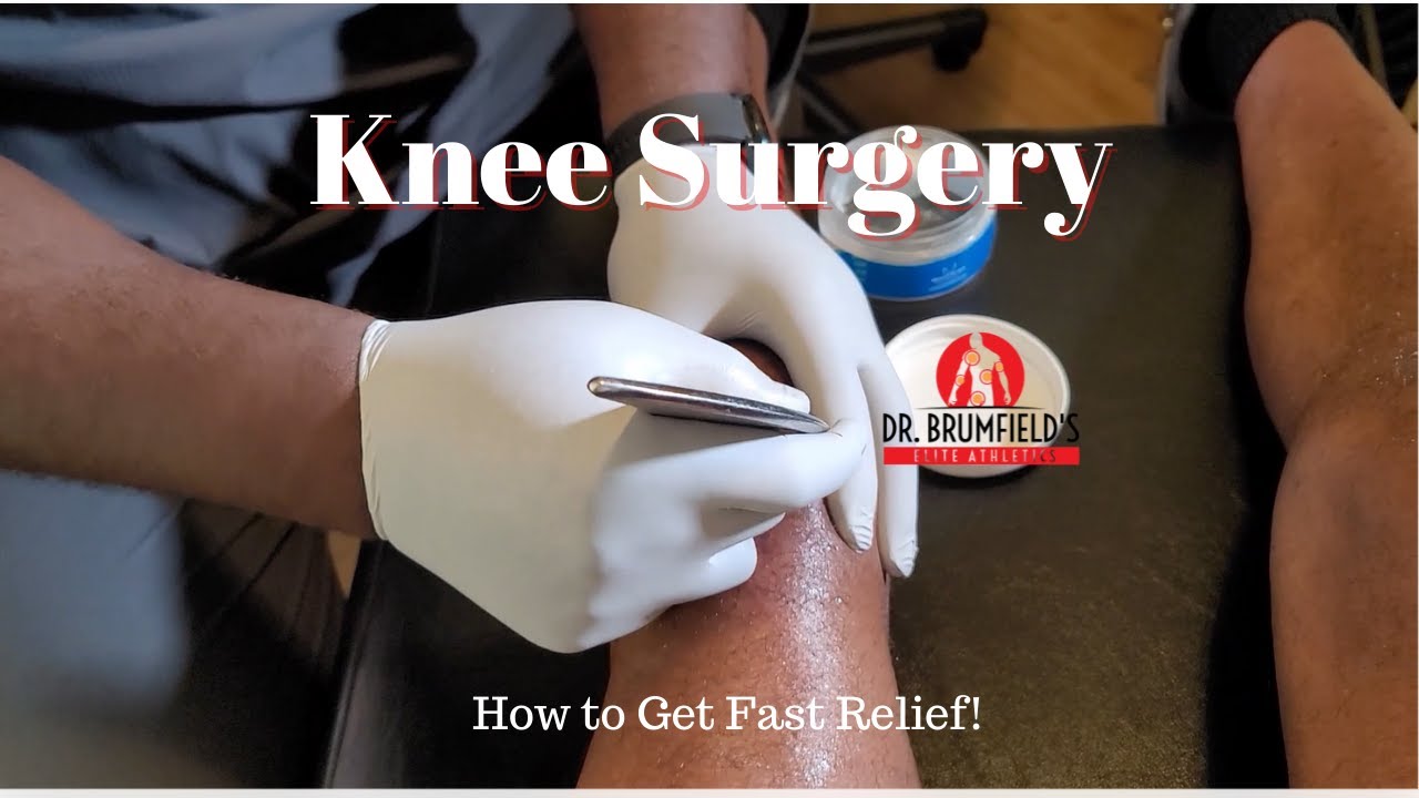 Knee Surgery Gone Wrong? This Changed Everything