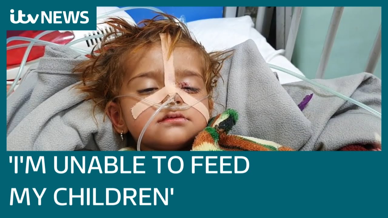 The faces of the children suffering from severe malnutrition in Afghanistan | ITV News