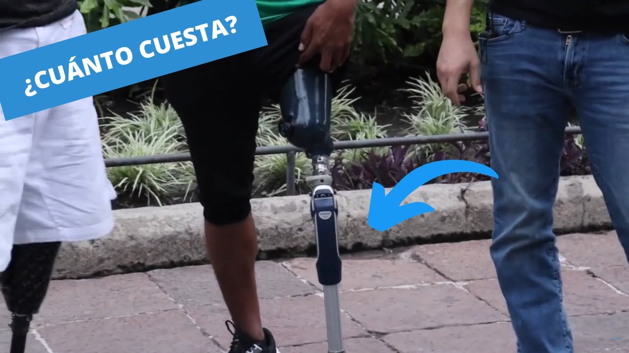 Episodio 160 ¿Costo de una prótesis de pierna en México ?