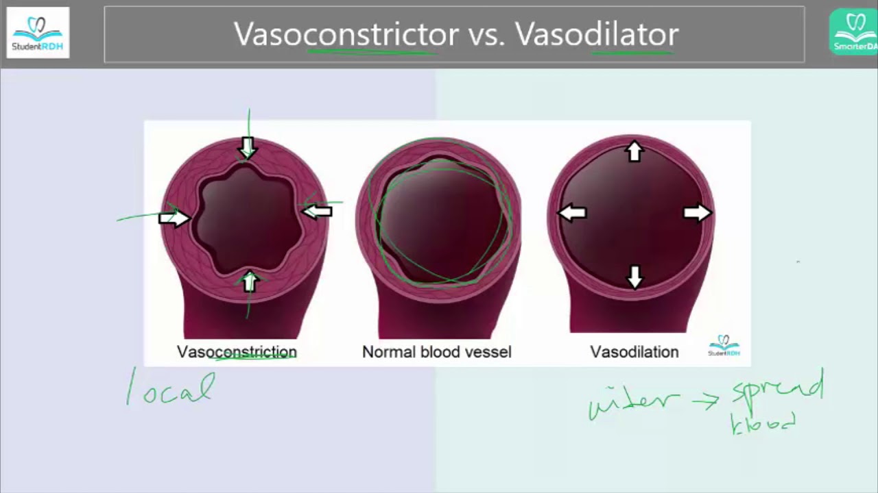[What's the difference] Vasoconstriction vs. Vasodilation