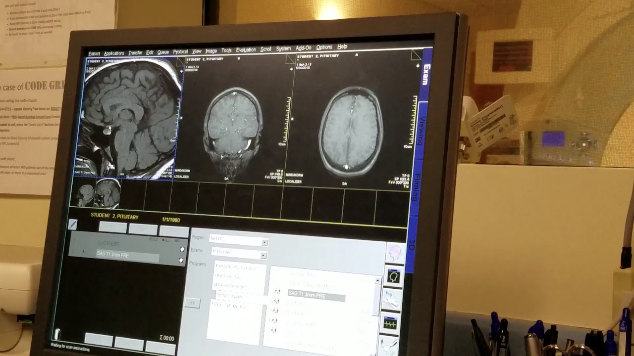 School of Medical Imaging MRI Lab   Pituitary