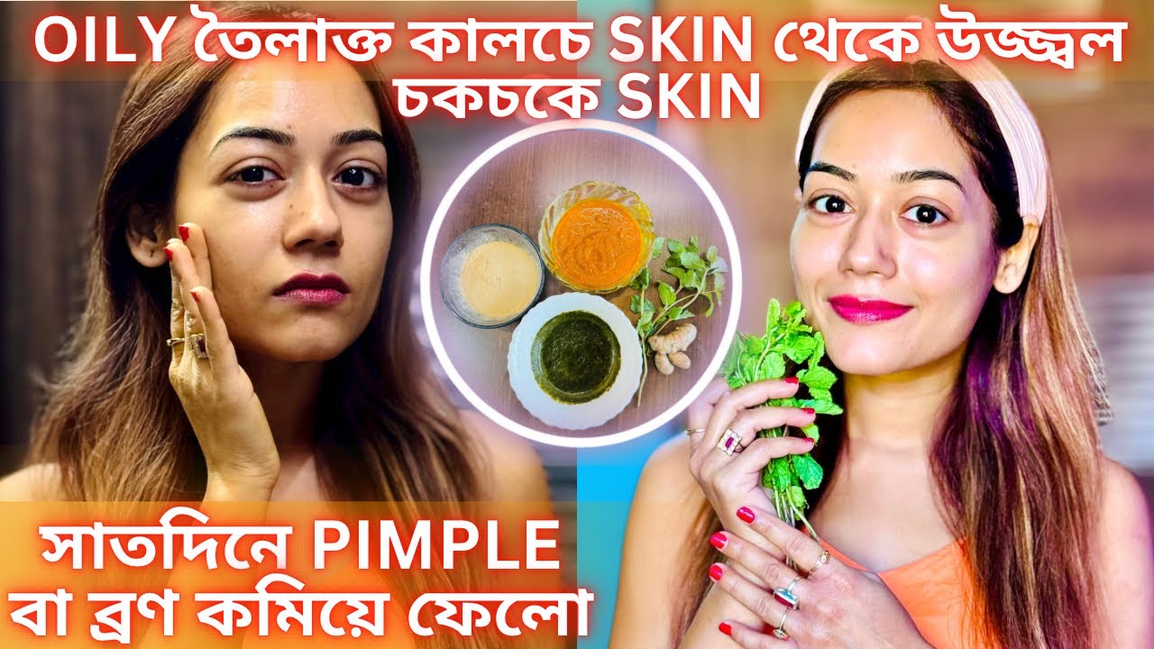 Oily তৈলাক্ত কালচে Skin থেকে উজ্জ্বল চকচকে Skin| সাতদিনে Pimple বা ব্রণ কমিয়ে ফেলো| #skin care