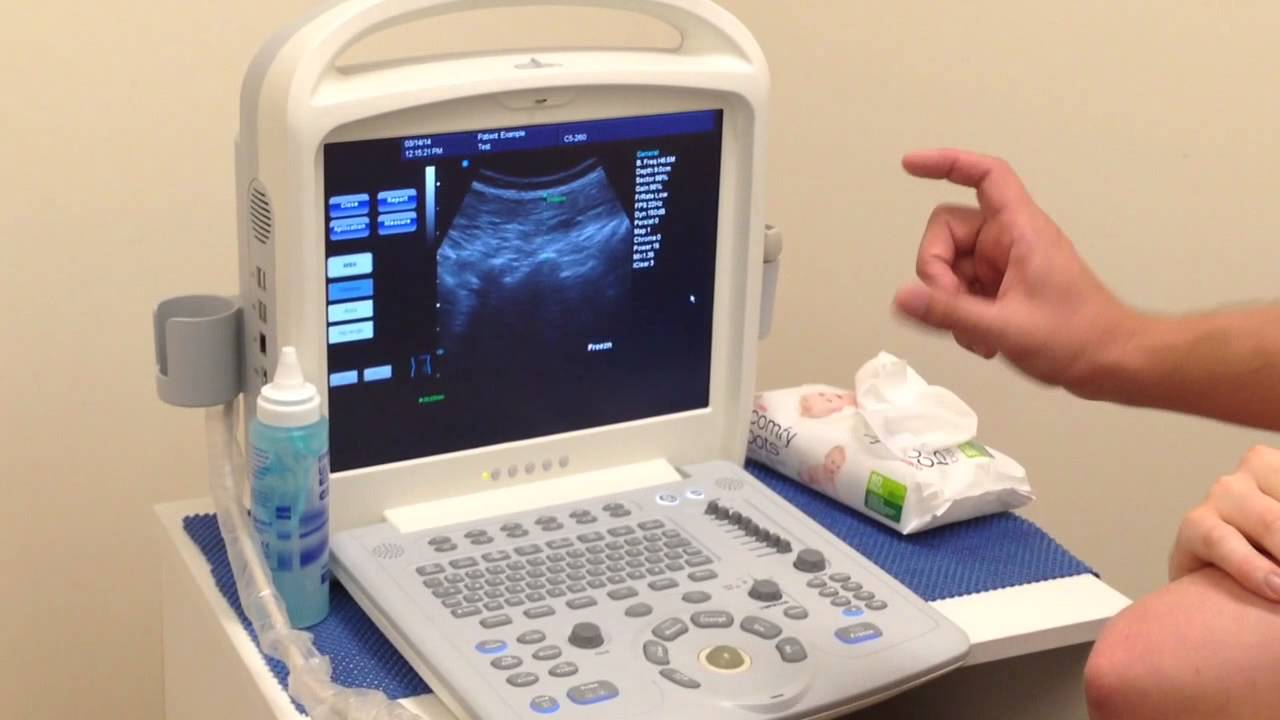 Real Time Ultrasound Rehabilitation of Multifidus