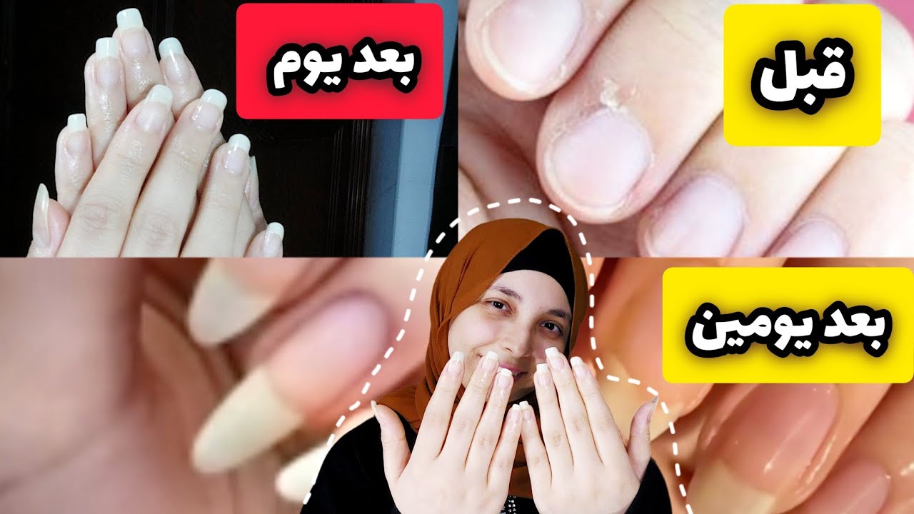 خلطة بمكون واحد فقط لتطويل الاظافر في يوم واحد و تلميعها و تبيضها و تقويتها مجربة و مضمونه 💕منة يسري