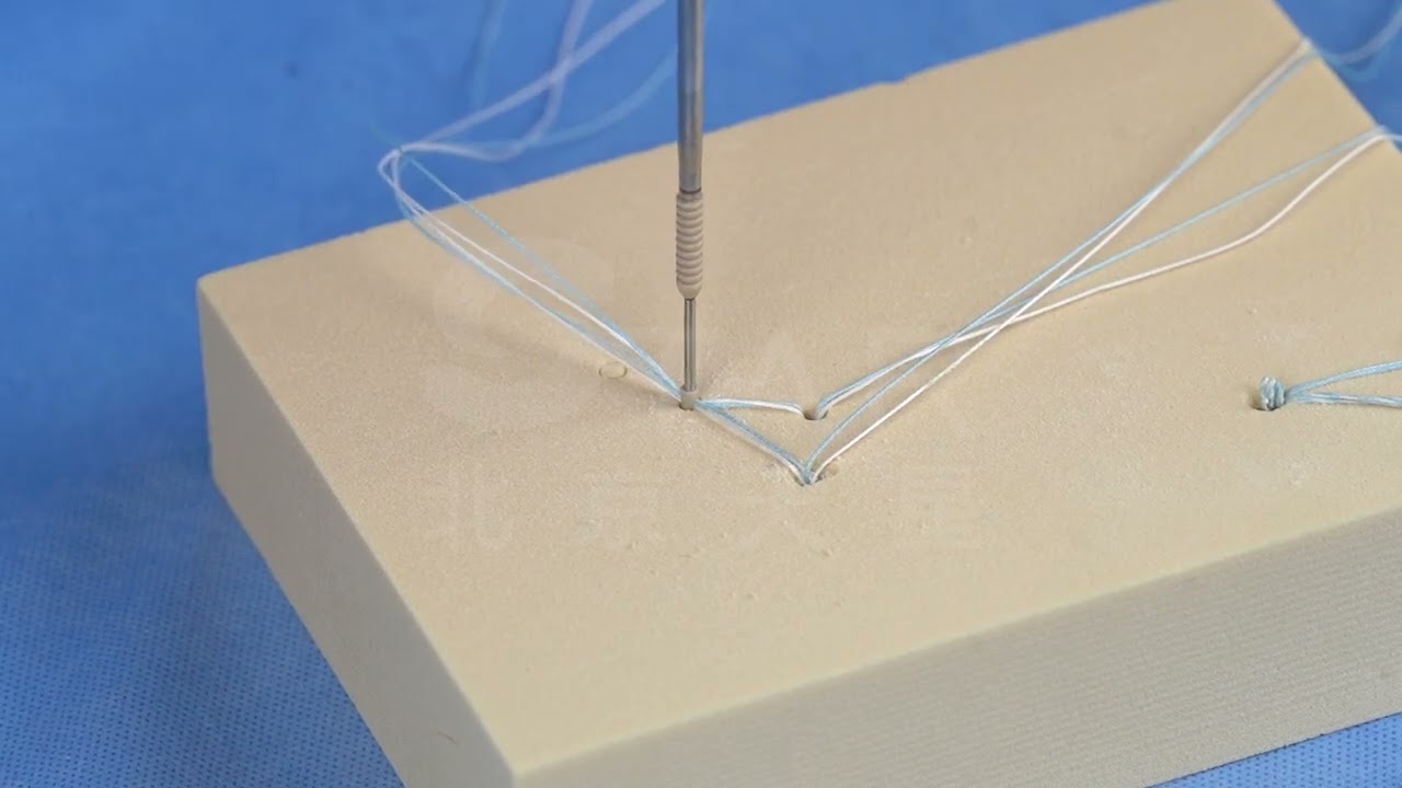 STAR TapScrew Knotless 3.0mm PEEK Suture Anchor - User Guide